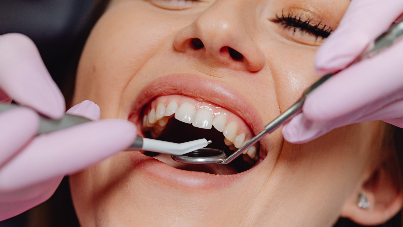 Small Tools, Big Impact: How Dental Handpieces Shape Patient Experience